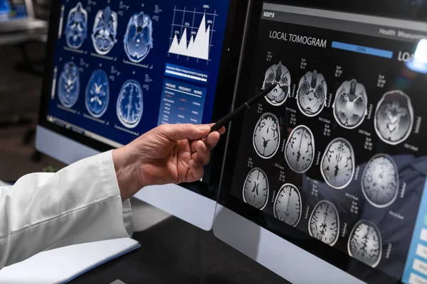 neurological side effects of chemotherapy