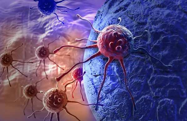 Exploring PD-L1 in Oral Cavity Cancers: Insights from a Tertiary Care Audit in India – IJSO
