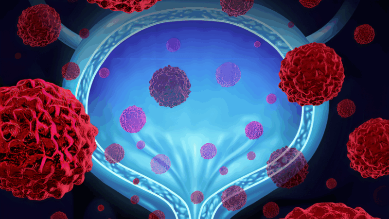 FDA Oncology – Overall Survival and PARP Inhibitors in Advanced Ovarian Cancer