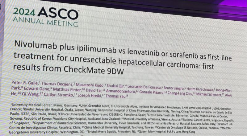 Kristina Jankovic: GI session and advanced HCC at NOK 2025 day 2