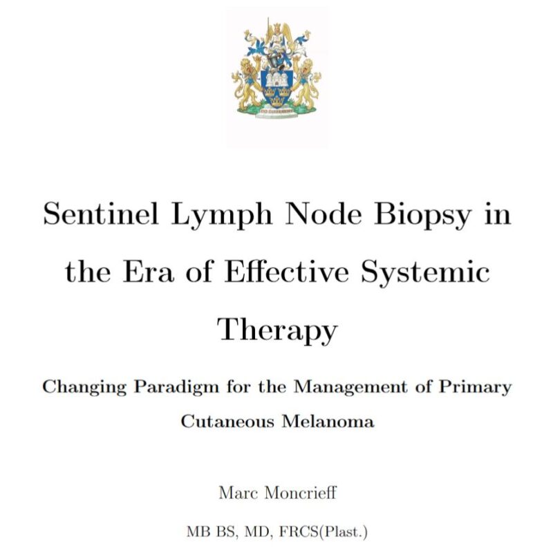 Winan van Houdt: Examining Marc Moncrieff’s PhD on SLNB in Melanoma