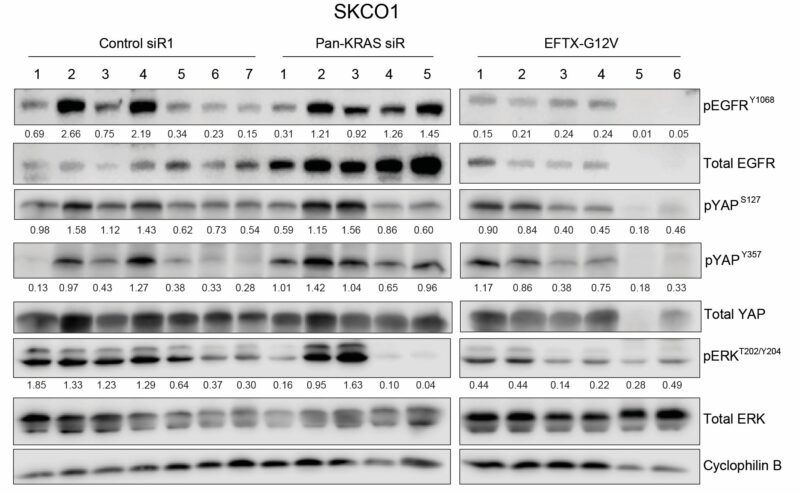 Chad Pecot: A First-in-Class EGFR-Directed KRAS G12V Selective Inhibitor