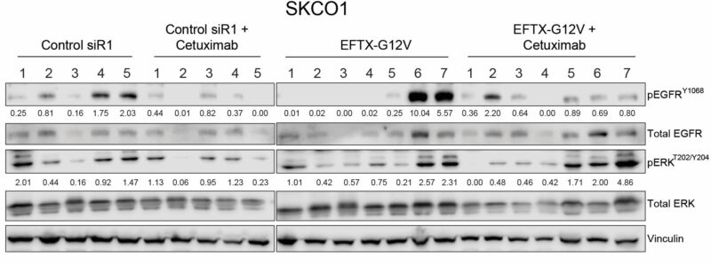 Chad Pecot: A First-in-Class EGFR-Directed KRAS G12V Selective Inhibitor