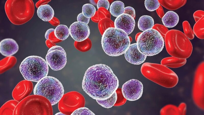 James P Crowley: Understanding Chronic Lymphocytic Leukaemia – Key Insights on TP53 Aberrations and BTK Inhibitors