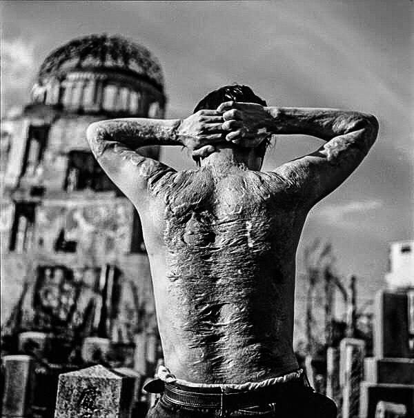 nuclear bomb cancer risk