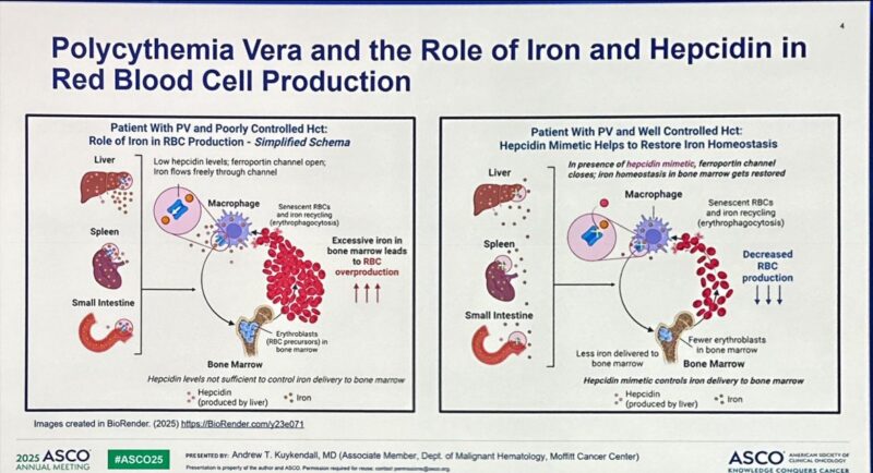 Amisha Gupta: Verify Trial on Rusfertide for Polycythemia Vera at ASCO