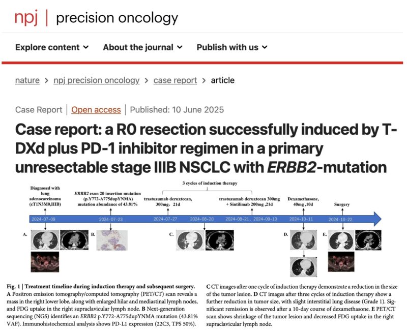 Oscar Tahuahua: Successful Surgical Conversion with T-DXd and PD-1 in ERBB2-Mutant NSCLC