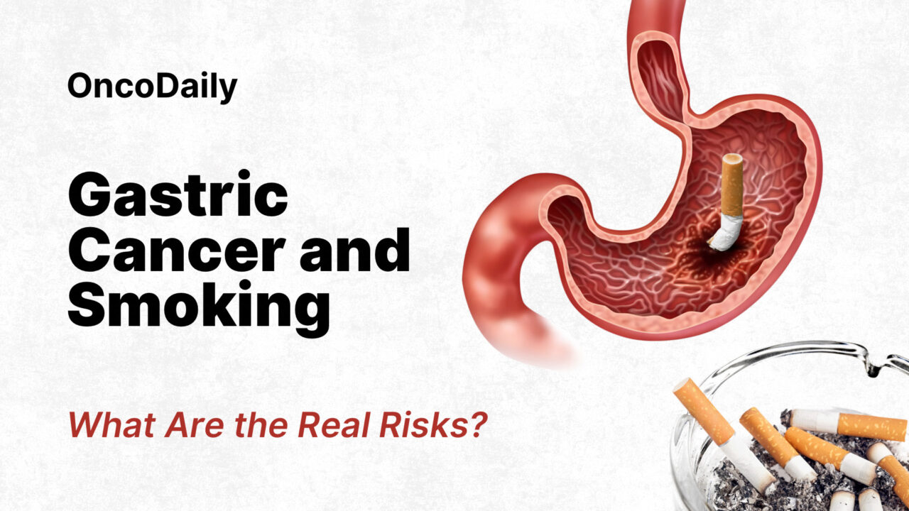 Gastric Cancer and Smoking — What Are the Shocking Real Risks?
