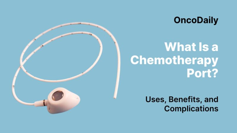 What Is a Chemotherapy Port? Uses, Benefits and Complications