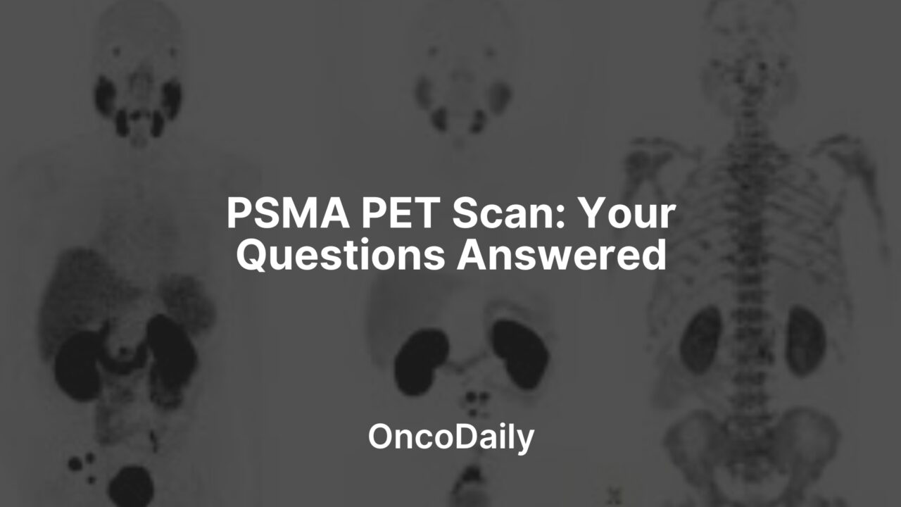 PSMA PET Scan: Your Questions Answered