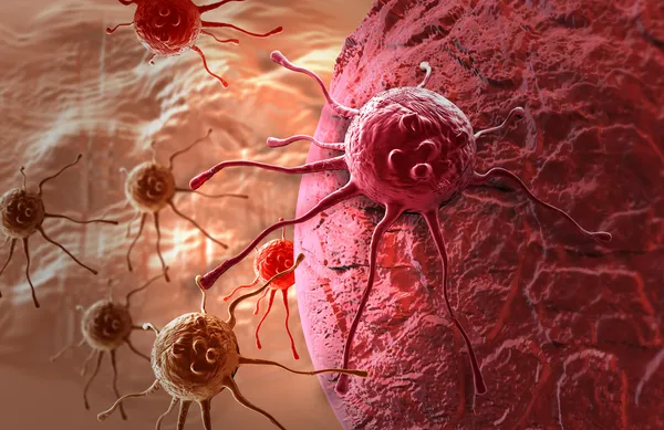 Smoking and bladder cancer