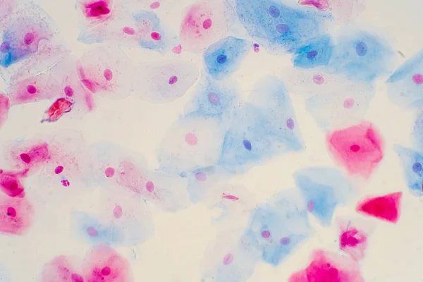 Pap Test, cervical cancer screening pap smear,
