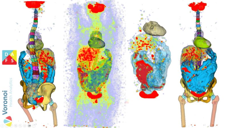 Mirza Faisal Beg: Staging the Host in Precision Medicine – The Under-explored Landscape