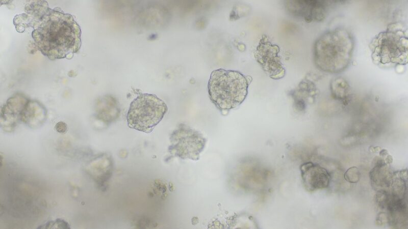 Genetic Differences Affect How the Immune System Sees Cancer Cells Even Within the Same Tumor – The Netherlands Cancer Institute