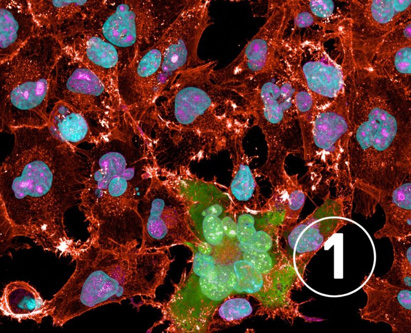 The Institute of Cancer Research