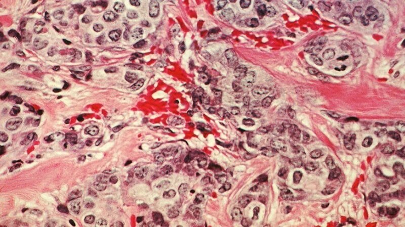 PARP Inhibitors