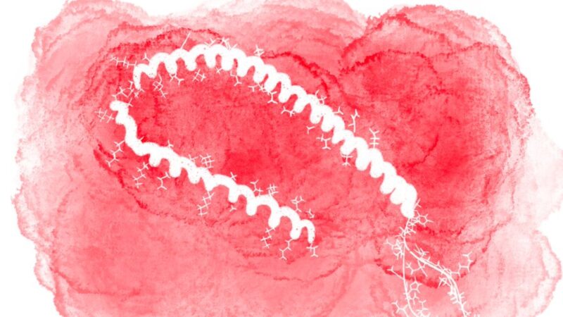 A protein once blamed for Parkinson’s may now be fueling melanoma – CancerWorld