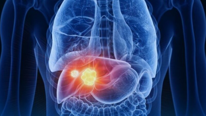 The results of the EORTC-1560-GITCG Multicentre Single-Arm Phase II Study – EORTC