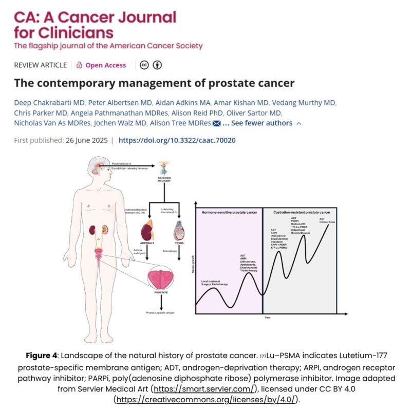 Global Trends in Prostate Cancer: Diagnostics, Treatment, and Surveillance - CA: A Cancer Journal for Clinicians