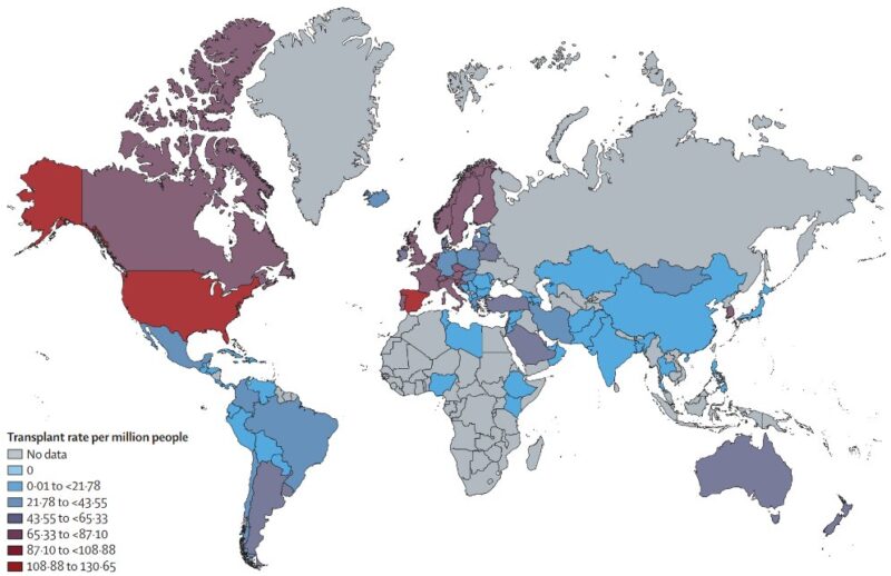 Promising Opportunities to Address Organ Shortages and Unequal Access to Organ Transplantation - The Lancet