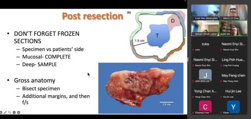 Melvin LK Chua: Discussing Oral Cavity Cancers with Head and Neck Cancer Experts