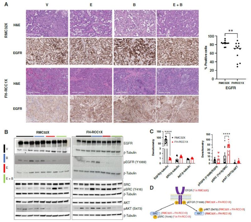 Bevacizumab 