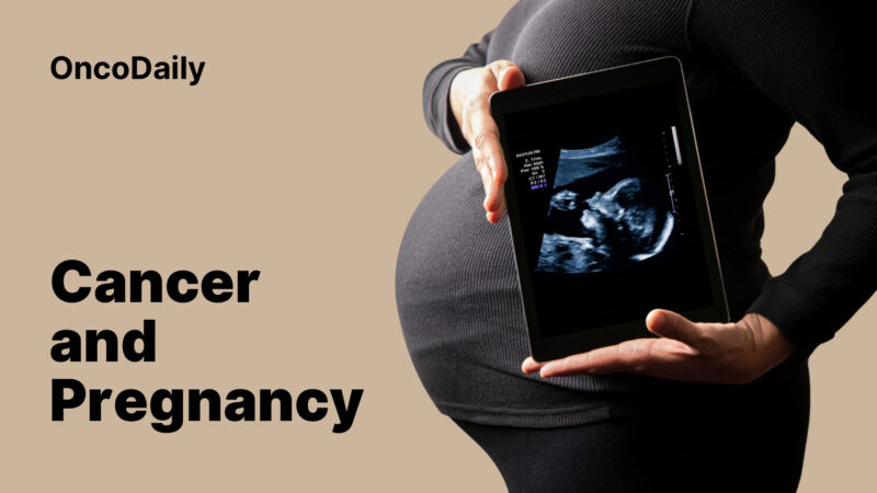 Radiotherapy in Pregnancy