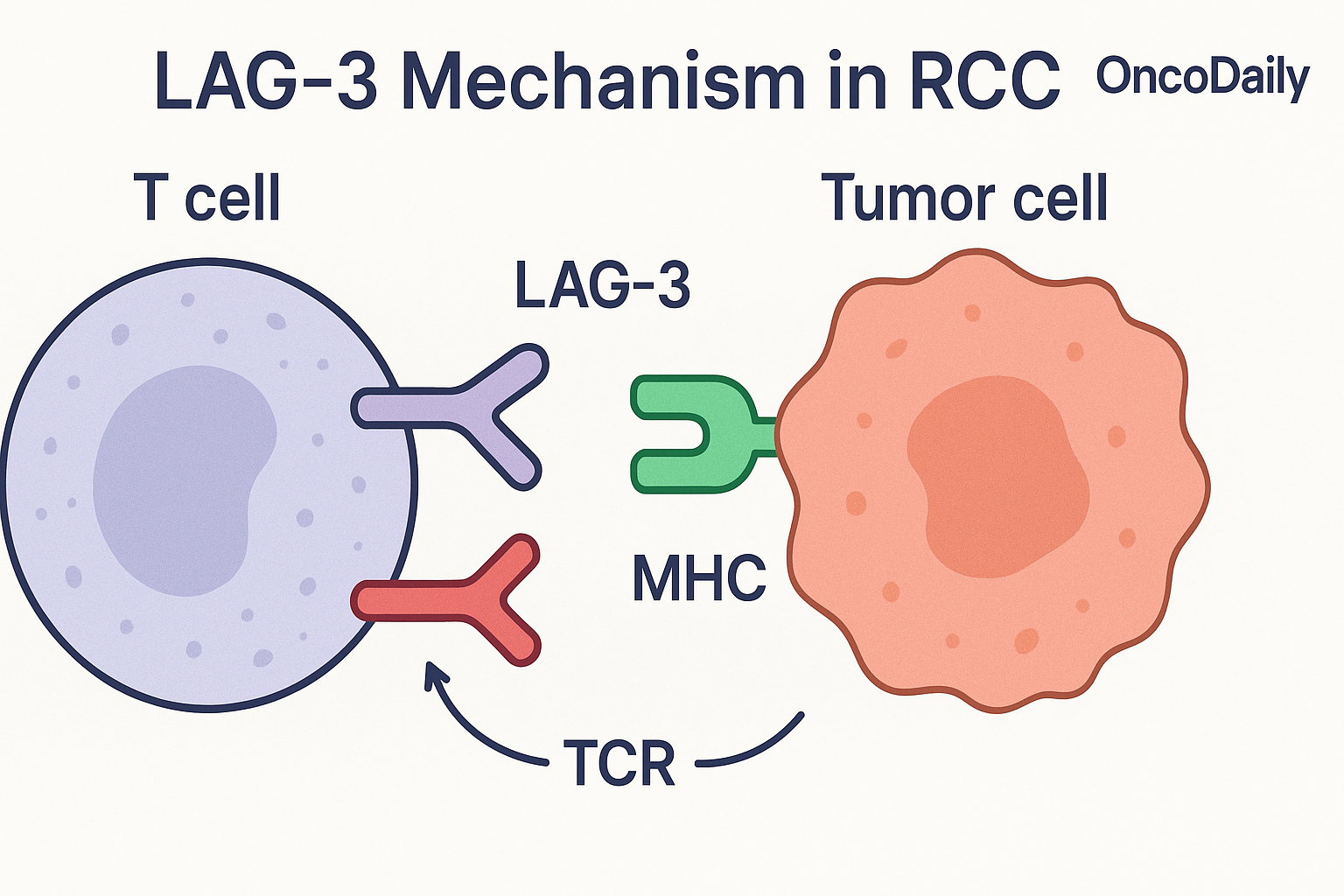 Top GU Immunotherapy Trials to Watch at ESMO 2025