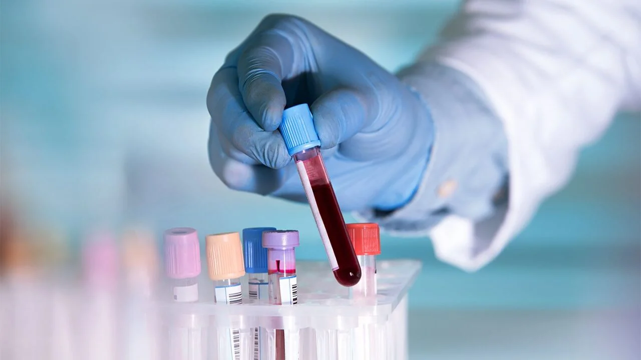 Multi-Cancer Early Detection