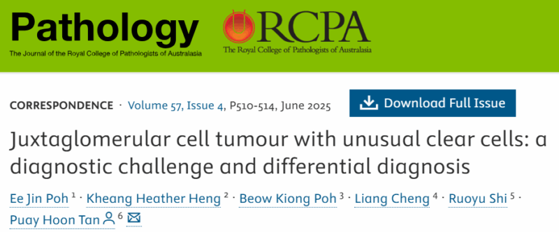 Juxtaglomerular cell tumour