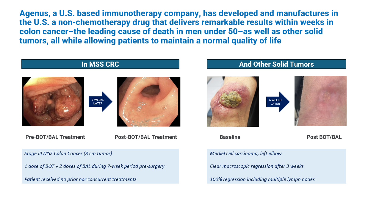 botensilimab colorectal cancer esmo gi 2025
