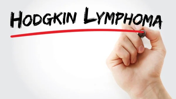 A New Online Tool is Helping Doctors Better Predict Relapse Risk in Early-Stage Hodgkin Lymphoma