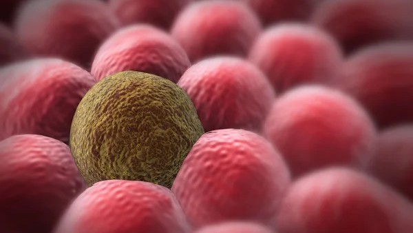 How Cancer Spreads – Involving Fragments So Small They’ve Only Just Been Recognised