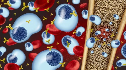 Rahul Banerjee: High Infection Risk With bsAbs in Myeloma