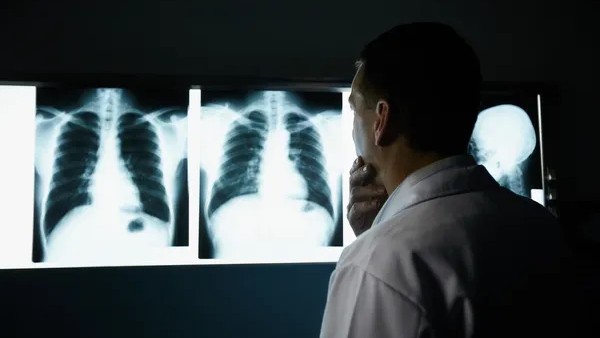 NIH Research Finds Disparities in Lung Cancer Mortality Between Urban and Rural Populations