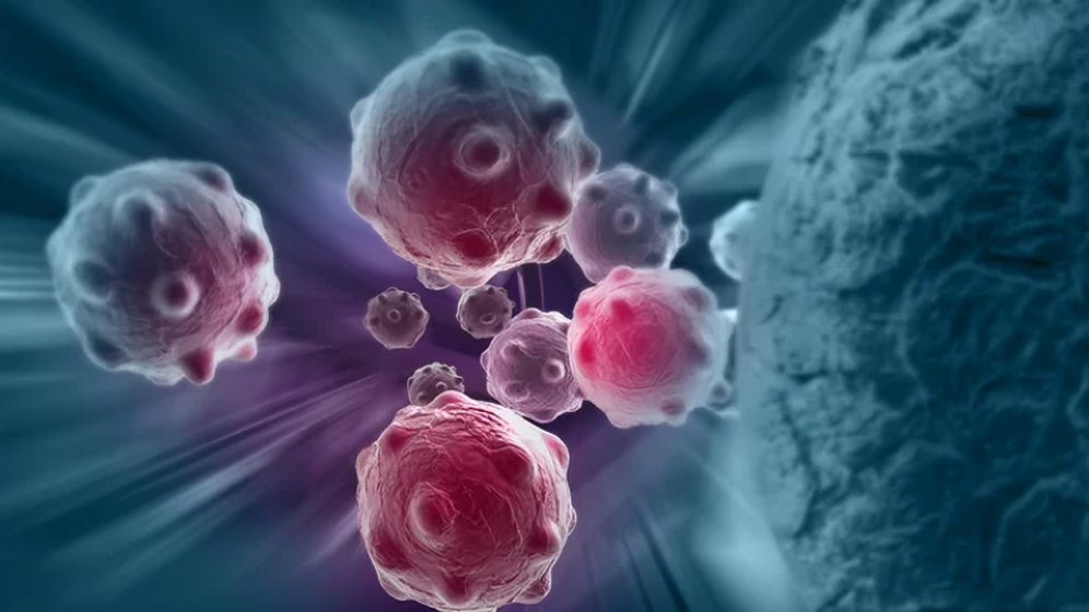Naveen Pemmaraju: Clonal Evolution of Hematopoietic Stem Cells Following Autologous Transplantation