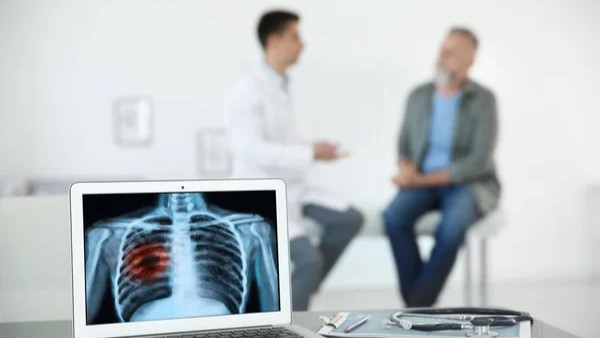 People with Lung Cancer are Excluded from Clinical Trials More Than Any Other Cancer Group