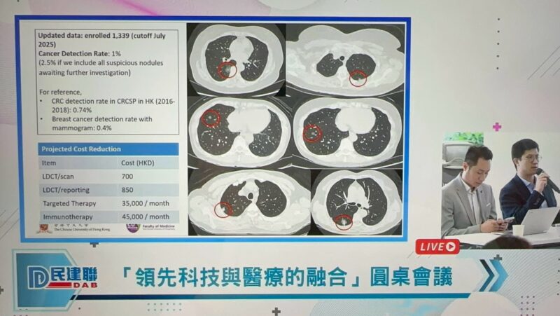 Norman Ng: Promoting the Implementation of AI Lung Cancer Screening in Hong Kong