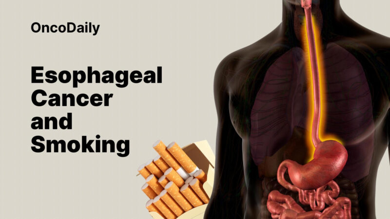 Esophageal Cancer and Smoking: What You Need to Know To Protect Yourself?