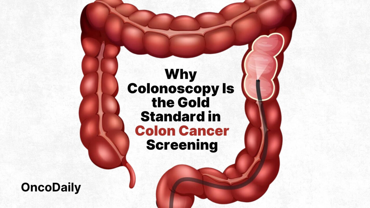 Why Colonoscopy Is the Gold Standard in Early Detection of Colon Cancer Screening