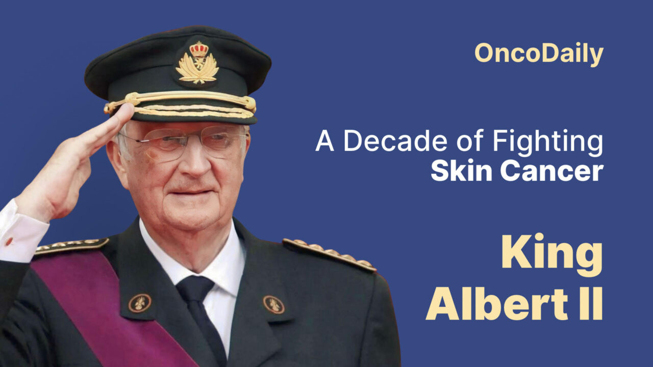 King Albert II’s Brave Battle: A Decade of Fighting Skin Cancer