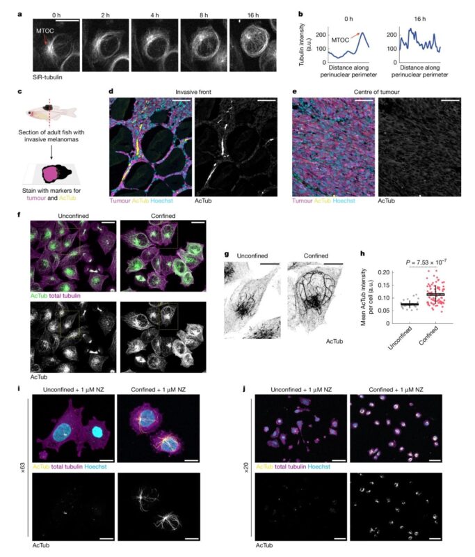 George Kumar: How Cancer Cells Change Their Identity Under Pressure 1 George Kumar