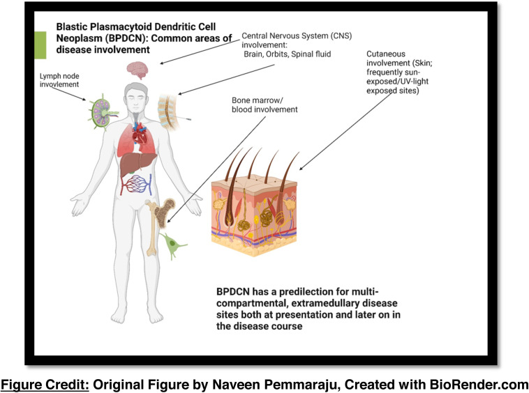 New Series by Nico Gagelmann: Rarity in Hematology - BPDCN