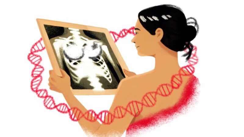Hidden Risks: BRCA Mutations and Breast Implants – CancerWorld