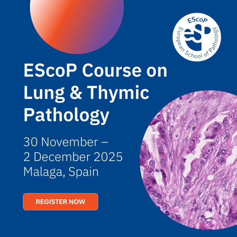 EScoP 