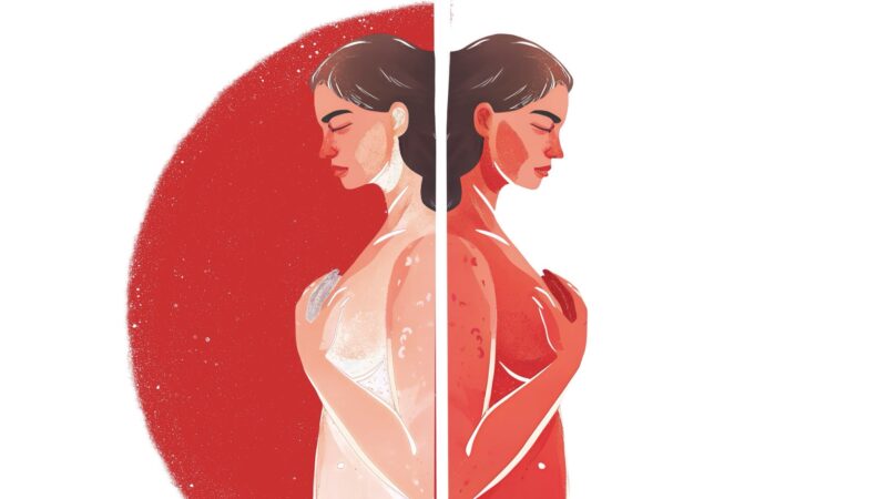 Post-Traumatic Growth in Cancer Patients – CancerWorld