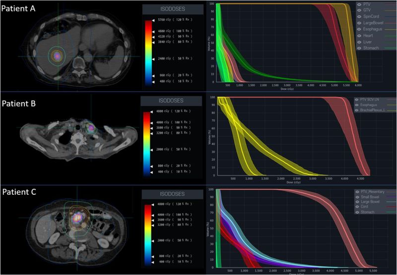 Applonia Rose: New in Technology in Cancer Research and Treatment