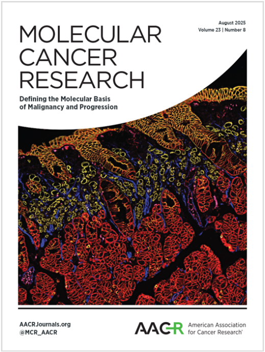 Jeremy L Davis: Spatial Analysis of Hereditary Diffuse Gastric Cancer