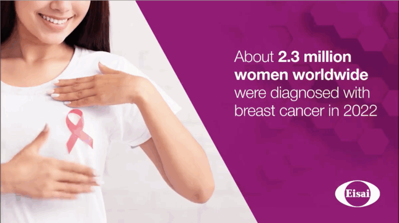 World Breast Cancer Research Day 2025