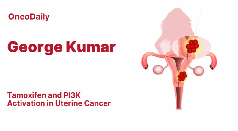 George Kumar: Tamoxifen and PI3K Activation in Uterine Cancer